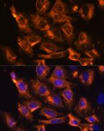 FAT4 Antibody in Immunocytochemistry (ICC/IF)