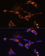 PDE12 Antibody in Immunocytochemistry (ICC/IF)