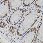 AKAP8 Antibody in Immunohistochemistry (Paraffin) (IHC (P))