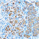 COG1 Antibody in Immunohistochemistry (Paraffin) (IHC (P))