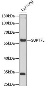 SUPT7L Antibody in Western Blot (WB)