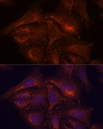 ENAH Antibody in Immunocytochemistry (ICC/IF)