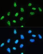 DHX9 Antibody in Immunocytochemistry (ICC/IF)