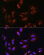 RALGDS Antibody in Immunocytochemistry (ICC/IF)