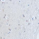 RALGDS Antibody in Immunohistochemistry (Paraffin) (IHC (P))