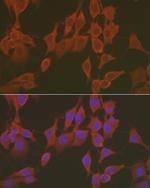 FNDC5 Antibody in Immunocytochemistry (ICC/IF)