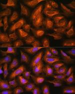 EIF2B4 Antibody in Immunocytochemistry (ICC/IF)