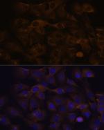 GRSF1 Antibody in Immunocytochemistry (ICC/IF)