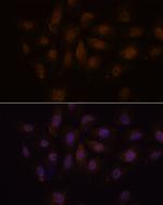 PCQAP Antibody in Immunocytochemistry (ICC/IF)