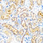 OSR1 Antibody in Immunohistochemistry (Paraffin) (IHC (P))