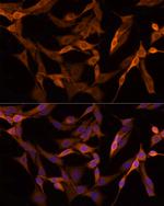 GSDMD Antibody in Immunocytochemistry (ICC/IF)