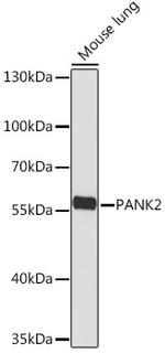 PANK2 Antibody in Western Blot (WB)