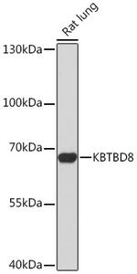 KBTBD8 Antibody in Western Blot (WB)