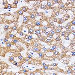 MITD1 Antibody in Immunohistochemistry (Paraffin) (IHC (P))