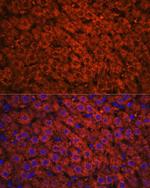 ADH1A/ADH1B/ADH1C Antibody in Immunohistochemistry (Paraffin) (IHC (P))