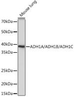 ADH1A/ADH1B/ADH1C Antibody in Western Blot (WB)