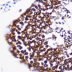 PTGES Antibody in Immunohistochemistry (Paraffin) (IHC (P))