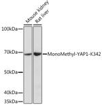 Methyl-YAP1 (Lys342) Antibody in Western Blot (WB)