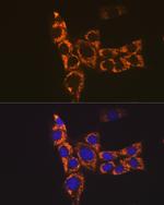 MHC Class II (I-Ab) Antibody in Immunocytochemistry (ICC/IF)