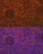 SIGLEC15 Antibody in Immunocytochemistry (ICC/IF)