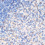 SIGLEC15 Antibody in Immunohistochemistry (Paraffin) (IHC (P))