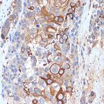 SIGLEC15 Antibody in Immunohistochemistry (Paraffin) (IHC (P))