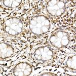 JNK1/JNK2/JNK3 Antibody in Immunohistochemistry (Paraffin) (IHC (P))