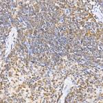 JNK1/JNK2/JNK3 Antibody in Immunohistochemistry (Paraffin) (IHC (P))