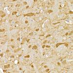 JNK1/JNK2/JNK3 Antibody in Immunohistochemistry (Paraffin) (IHC (P))