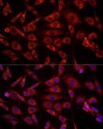 VDAC2 Antibody in Immunocytochemistry (ICC/IF)