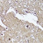 VDAC2 Antibody in Immunohistochemistry (Paraffin) (IHC (P))