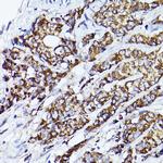 VDAC2 Antibody in Immunohistochemistry (Paraffin) (IHC (P))