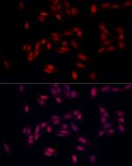 SUPT16H Antibody in Immunocytochemistry (ICC/IF)