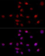 SUPT16H Antibody in Immunocytochemistry (ICC/IF)