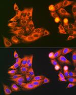 VAMP7 Antibody in Immunocytochemistry (ICC/IF)