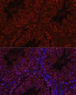 C1orf146 Antibody in Immunohistochemistry (Paraffin) (IHC (P))