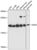 LMO2 Antibody in Western Blot (WB)