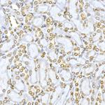 Lamin B1 Antibody in Immunohistochemistry (Paraffin) (IHC (P))