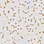 Lamin B1 Antibody in Immunohistochemistry (Paraffin) (IHC (P))