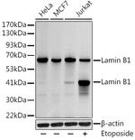 Lamin B1 Antibody in Western Blot (WB)