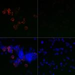 SARS-CoV-2 Spike Protein S1 Antibody in Immunocytochemistry (ICC/IF)