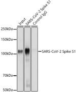 SARS-CoV-2 Spike Protein S1 Antibody in Immunoprecipitation (IP)