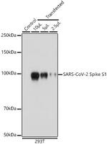 SARS-CoV-2 Spike Protein S1 Antibody in Western Blot (WB)