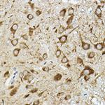 ATP6V1G2 Antibody in Immunohistochemistry (Paraffin) (IHC (P))