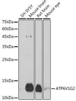ATP6V1G2 Antibody in Western Blot (WB)