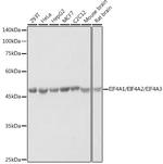 EIF4A1/EIF4A2/EIF4A3 Antibody in Western Blot (WB)