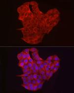 EXT1 Antibody in Immunocytochemistry (ICC/IF)