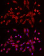 EXT1 Antibody in Immunocytochemistry (ICC/IF)