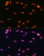 ALOX5 Antibody in Immunocytochemistry (ICC/IF)