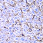 HLA-A Antibody in Immunohistochemistry (Paraffin) (IHC (P))